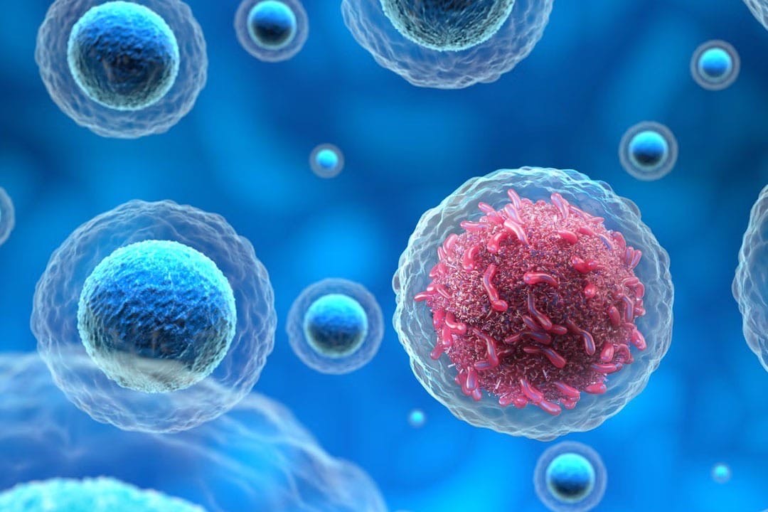 cf45cbce-de3c-46af-92e3-140bb13dfd88