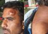 రాళ్లతో దాడి  బాధితుడికి న్యాయం చేయాలి