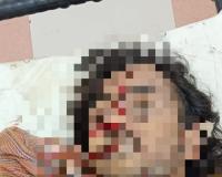 అతివేగంతో స్తంబానికి బైక్ డీ కొని గిరిజన యువకుడి దుర్మరణం