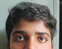 గురుకుల పాఠశాల విద్యార్థి ఆత్మహత్యాయత్నం 